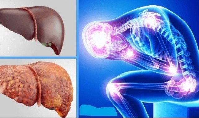 Karaciğer nakilleri arttı, hastalık önlenebilir
