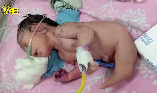 Hindistan'da doğan bebek doktorları şoke etti !
