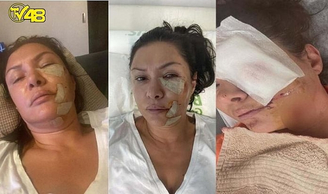 TUĞBA ALTINTOP'A KÖPEK SALDIRDI!