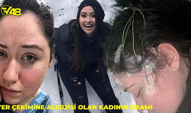 'Yer çekimi' alerjisi var!