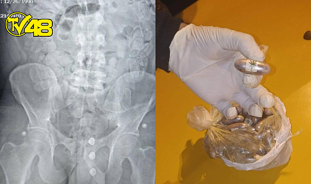 1,5 kilo reçine esrarı yutarak Fas'tan Türkiye'ye getirdi! Kokusu ele verince yakalandı